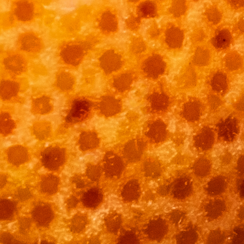 Vitamin B1 (Thiamine)